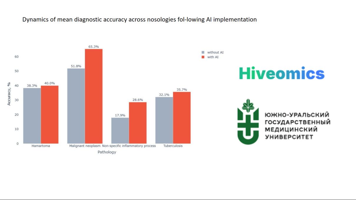 How AI Helps Us See More: Results of Evaluating the Hiveomics Malignancy Index Among Radiology Residents